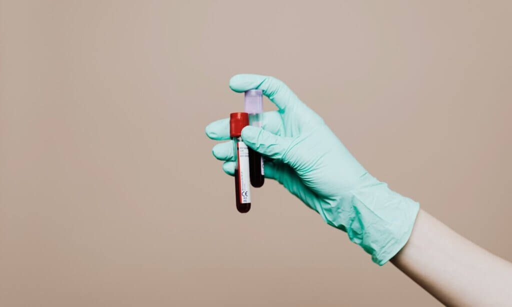 Aus diesen Gründen wird zunehmend der Begriff „Präzisionsmedizin“ verwendet. Er beschreibt einen datengetriebenen Ansatz, der auf der Analyse großer, vielfältiger Datensätze basiert.