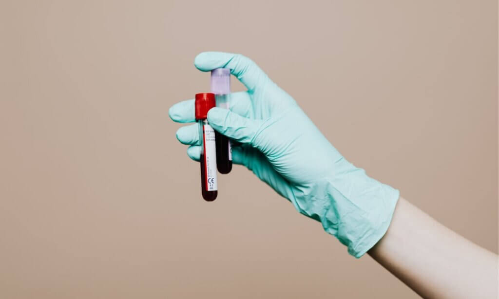 Dejan Milosavljevic, MSc widmete sich einem in der Praxis zunehmend relevanten Phänomen: der unkritischen Nutzung von Selbsttests im Ernährungs- und Lifestyle-Bereich. 