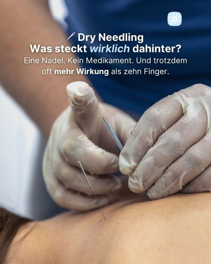 Von der Wirkweise über die richtige Indikationsstellung bis zur neuen Rechtslage in Österreich: Ein fundierter Überblick für PhysiotherapeutInnen, die Dry Needling sicher und evidenzbasiert einsetzen wollen.
